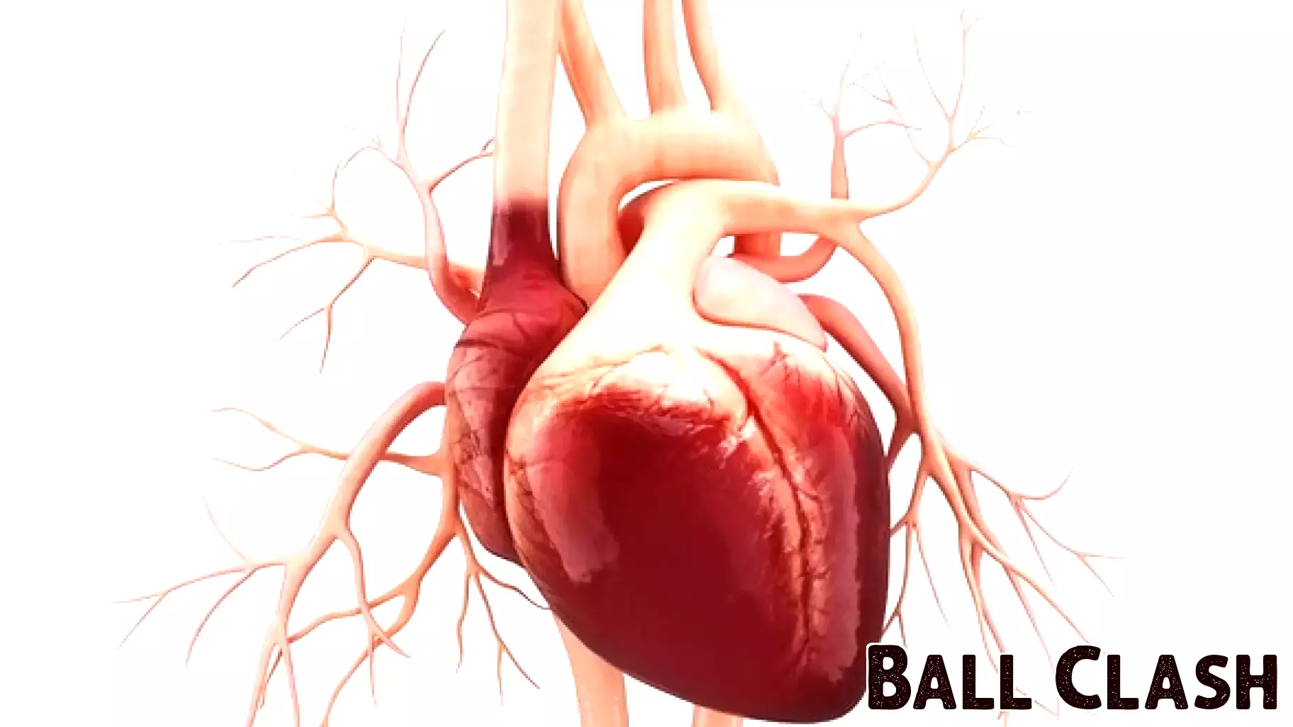 New Insights on Athletes with Heart Conditions and Competitive Sports Participation